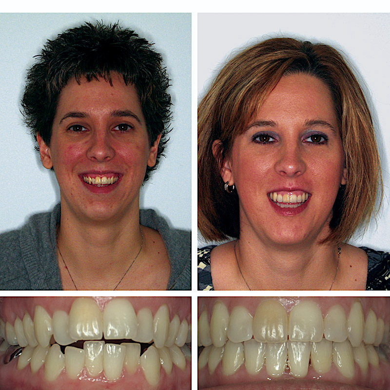 Smile Transformation Case