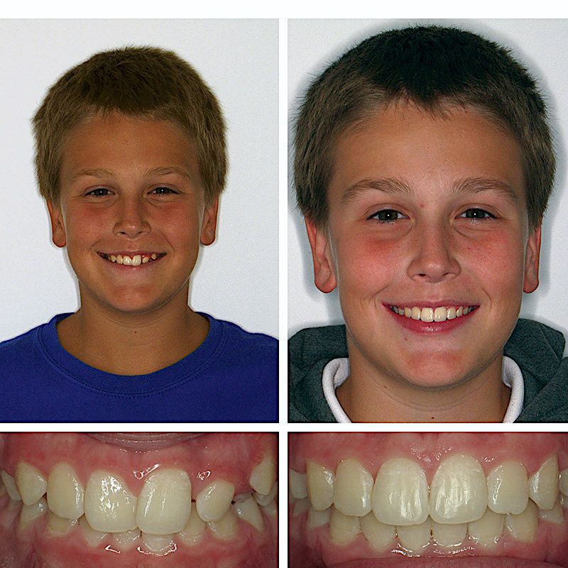 Smile Transformation Case