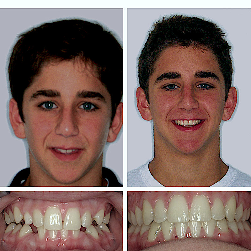 Smile Transformation Case