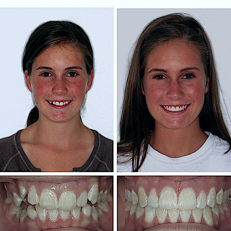 Smile Transformation Case