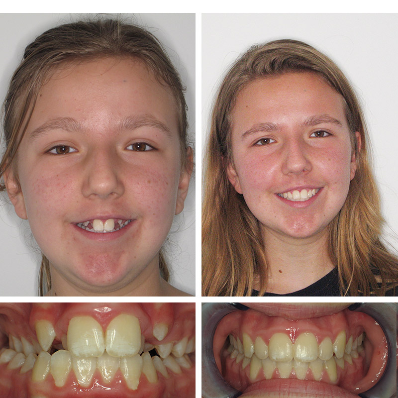 Smile Transformation Case