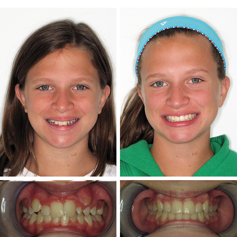 Smile Transformation Case