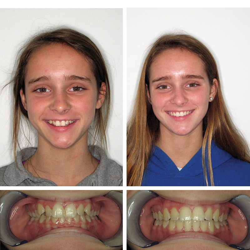 Smile Transformation Case