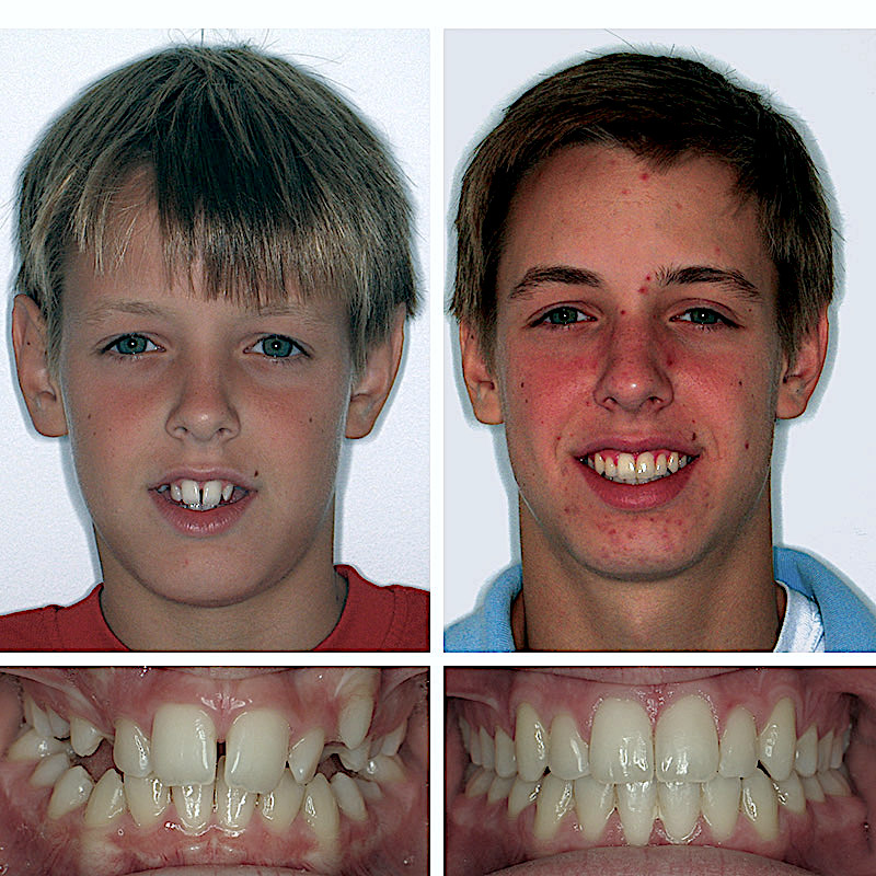 Smile Transformation Case