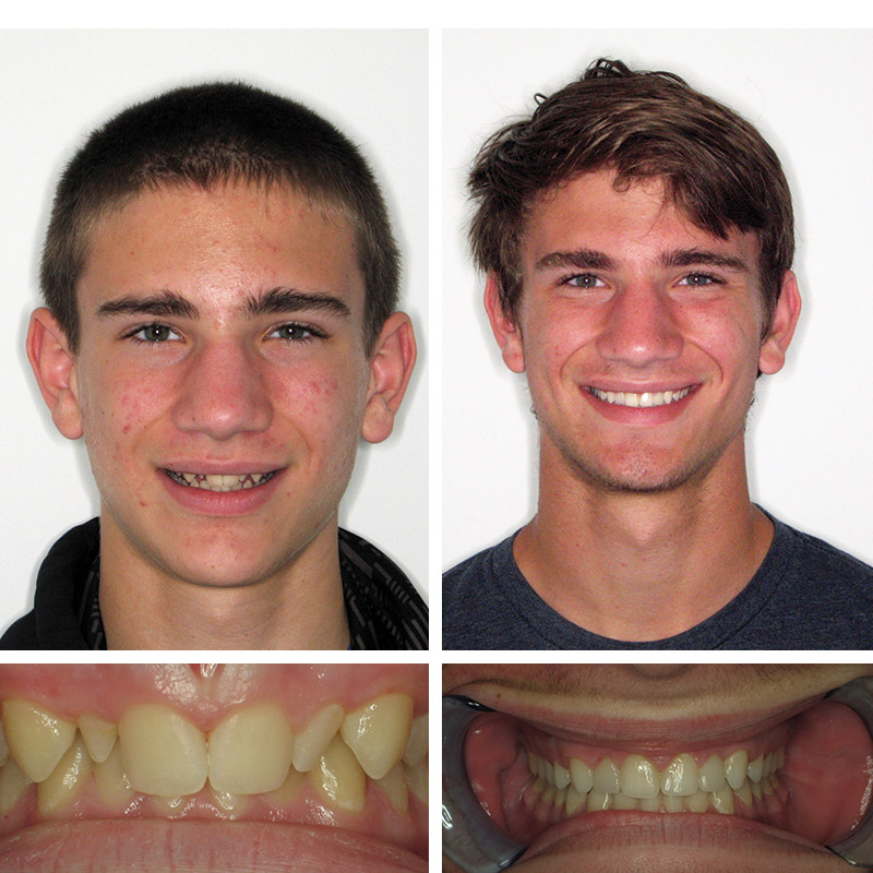 Smile Transformation Case